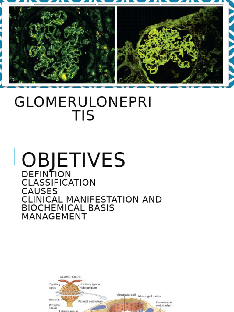 GLOMERULONEPHRITIS | PDF | Medical Specialties | Nephrology