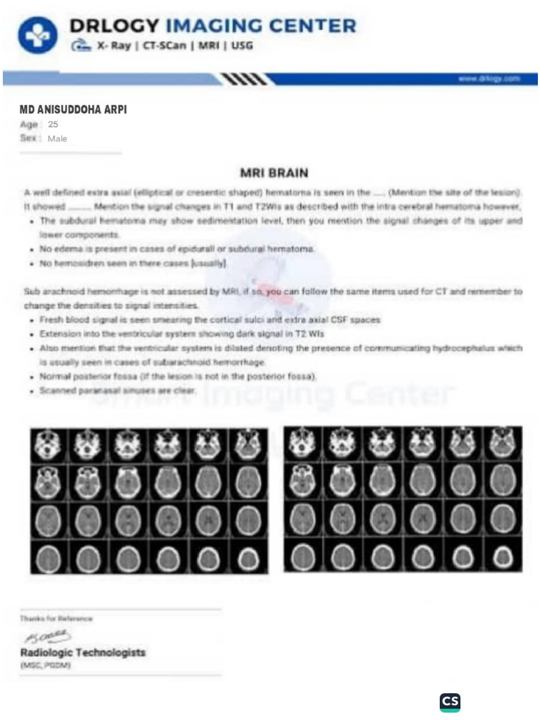Brain Report | PDF