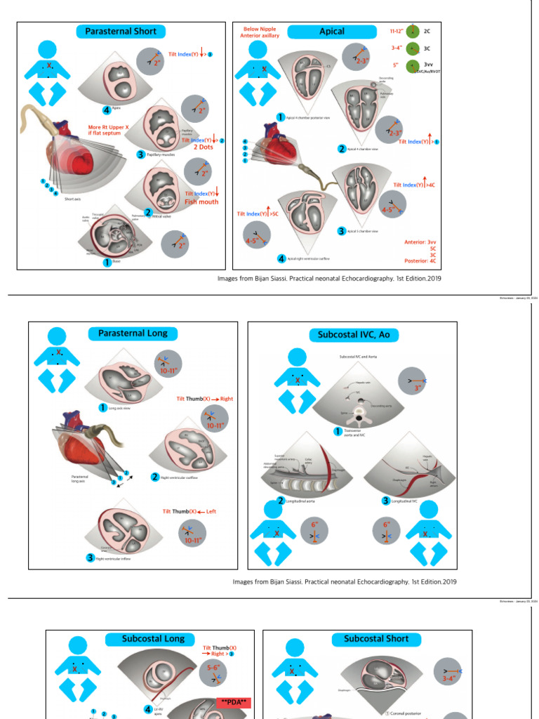 Echoviews | PDF