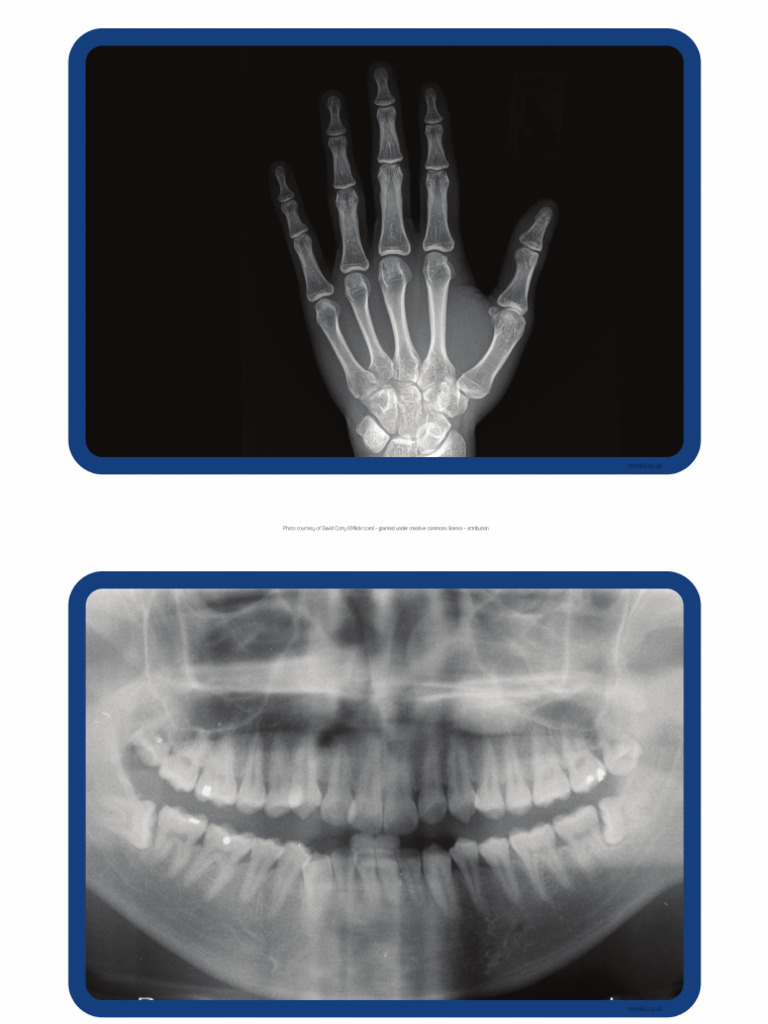 T T 2544341b X Ray Display Photos No Labels | PDF