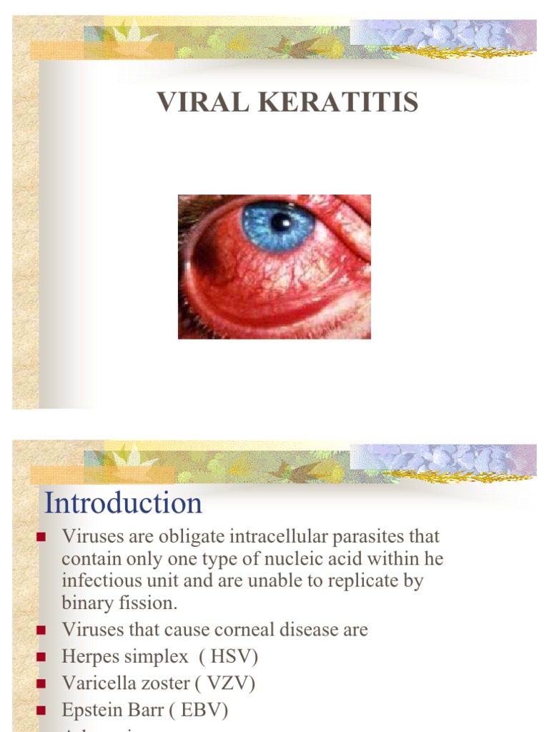 Viral Keratitis Viral Diseases Medical
