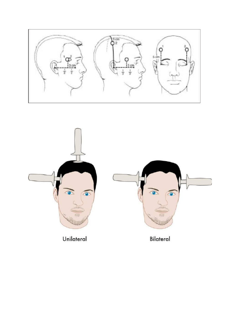 Ect Image | PDF