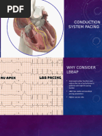 Septal Implantation of Right Ventricular Lead - How To Pace | PDF ...