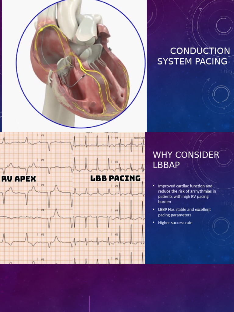 Dr Niraj Raghani CSP | PDF | Electrocardiography | Artificial Cardiac ...