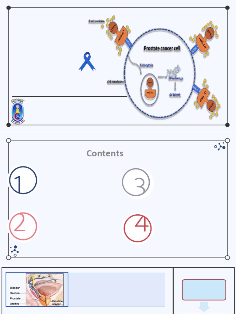 Lu177 Evaluation PDF | PDF | Prostate Cancer | Metastasis
