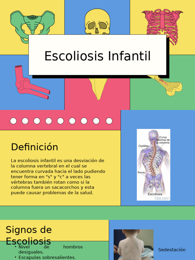 Epidemiología y Tratamiento de Escoliosis Infantil | PDF | Escoliosis ...