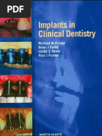 Download Implants in Clinical Dentistry 2002 - Palmer by Ankiarah SN81384860 doc pdf