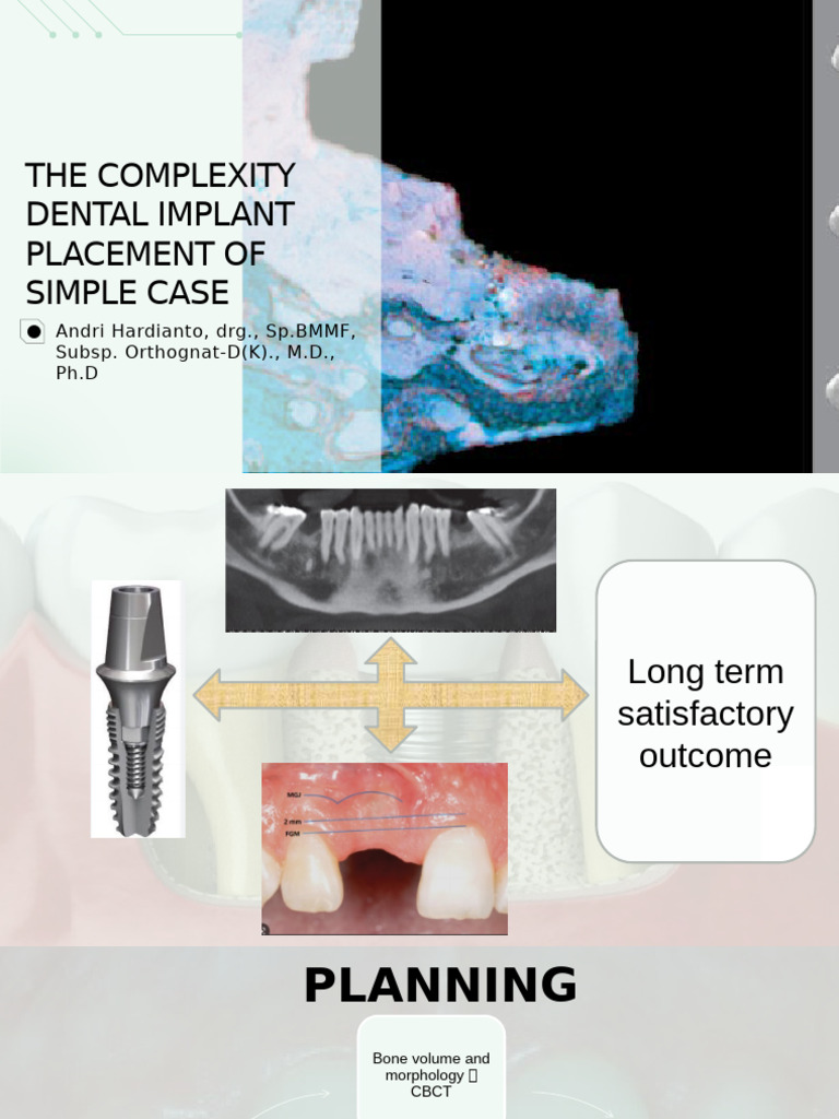 The Complexity Dental Implant Placement of Simple Case | PDF | Dental ...