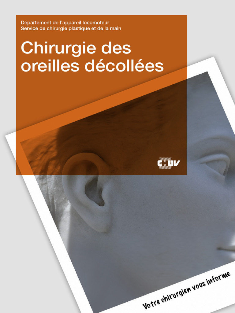Otoplastie Correction des oreilles décollées PDF Chirurgie — free download