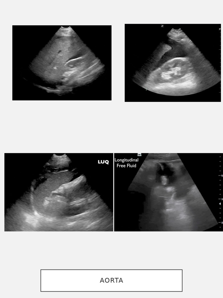 Ultrasound Assessment of Shock | PDF | Medical Specialties | Diseases ...