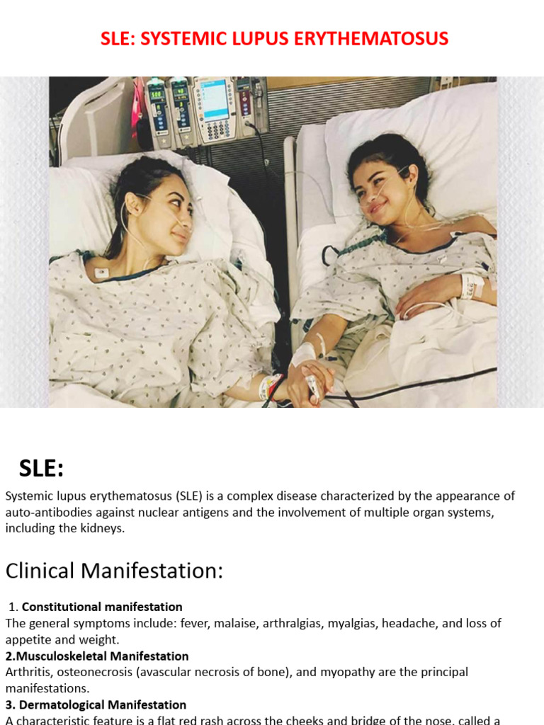 Immunotherapeutics in SLE | PDF | Autoimmunity | B Cell