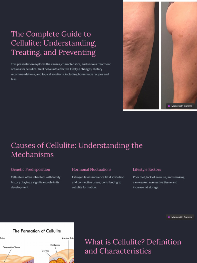The Complete Guide To Cellulite Understanding Treating and Preventing ...
