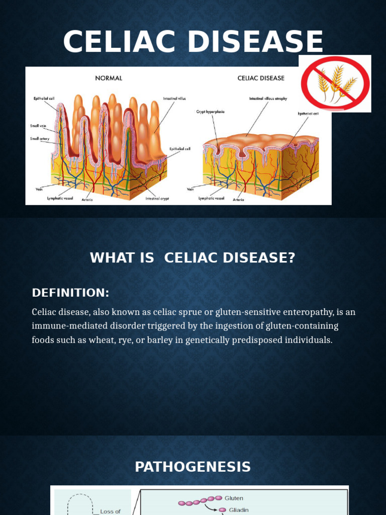 Celiac Disease New | PDF | Coeliac Disease | Diseases And Disorders