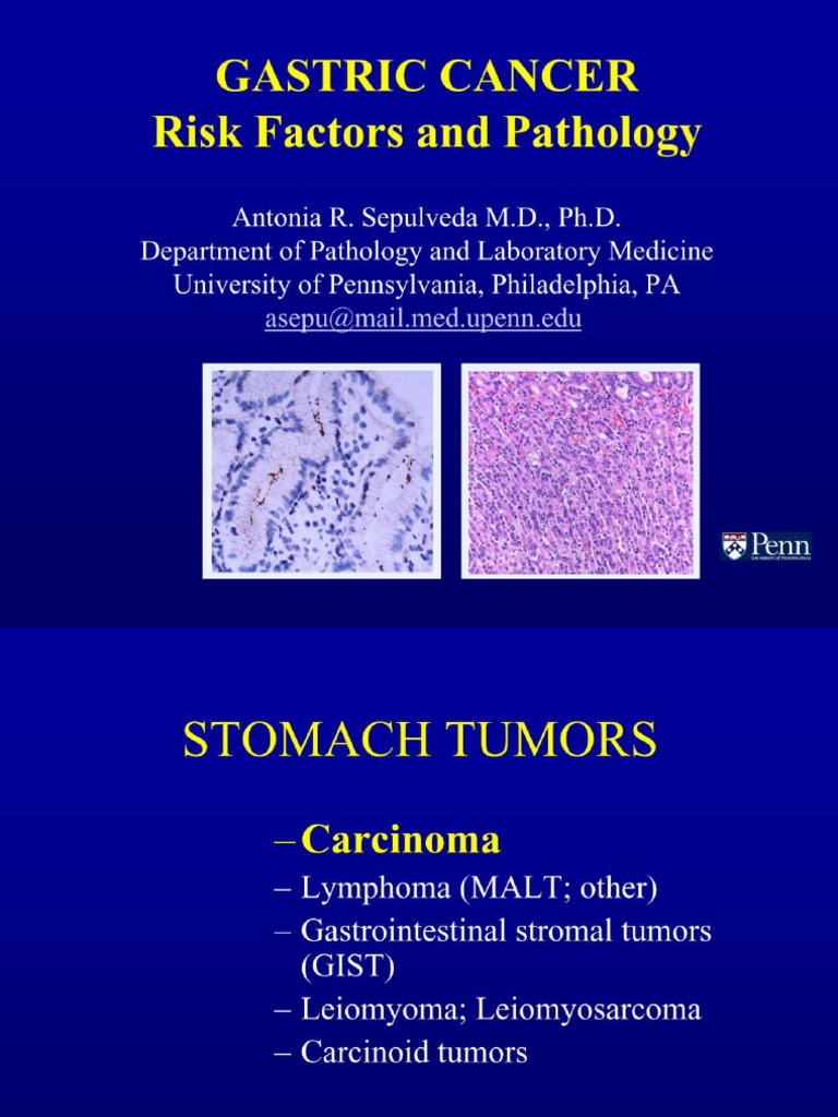 GASTRIC CANCER Risk Factors and Pathology | PDF