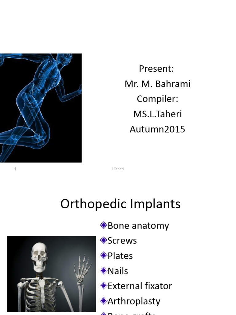 Principle of Orthopedic Implants 85901 | PDF | Screw | Sphere