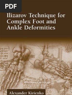 Ilizarov Technique for Complex Foot and Ankle Deformities Oxidative Stress Amp Disease