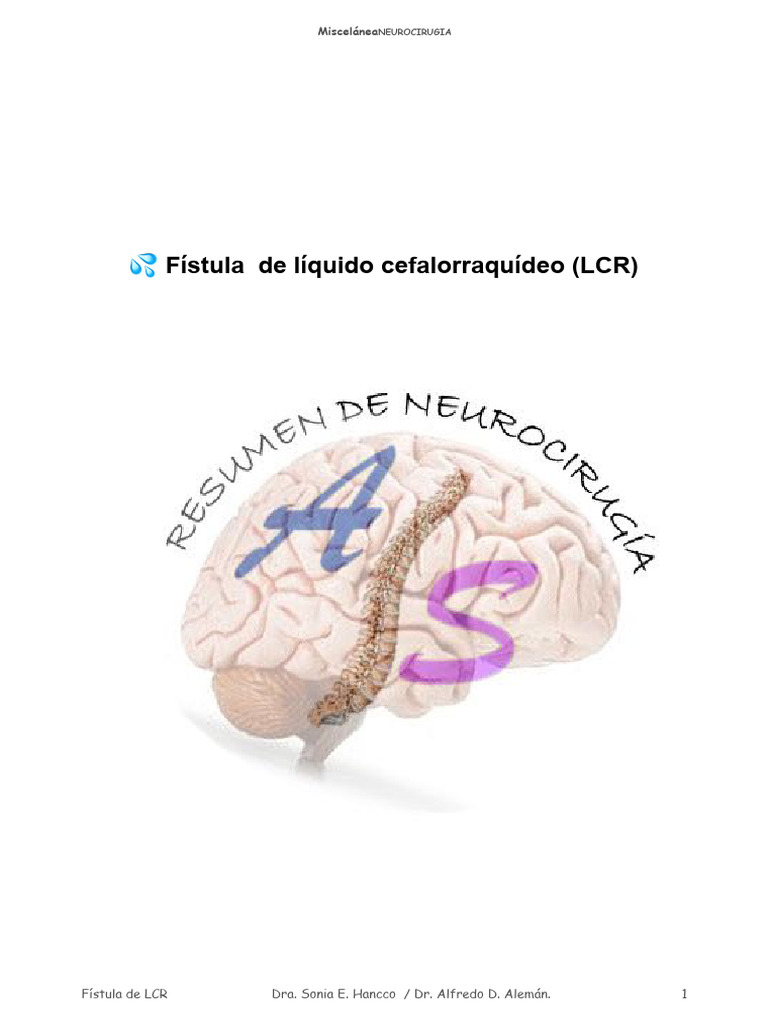 Fístula de LCR: Diagnóstico y Tratamiento | PDF | Fluido cerebroespinal ...