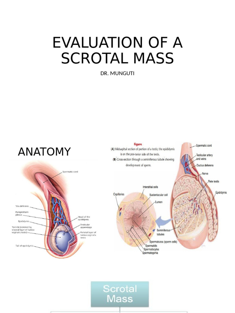 Scrotal Mass Evaluation Guide | PDF | Testicle | Diseases And Disorders