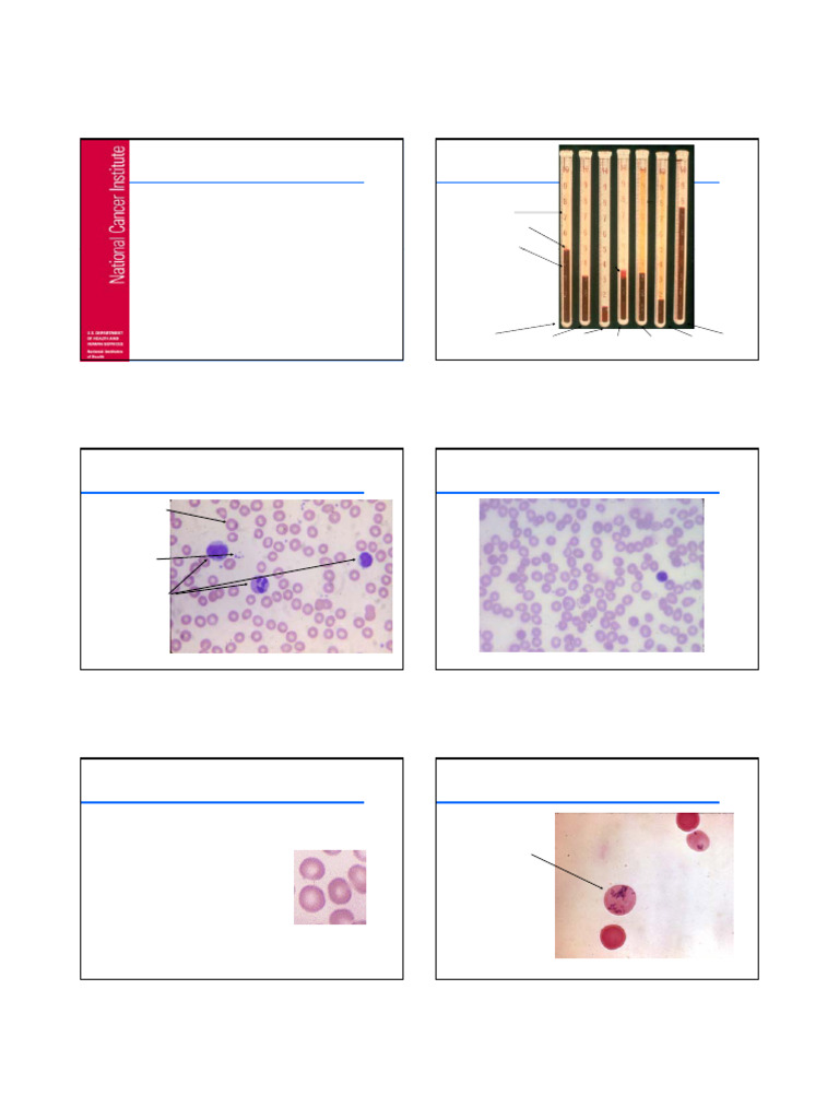 Hematology_101 | PDF | White Blood Cell | Granulocyte