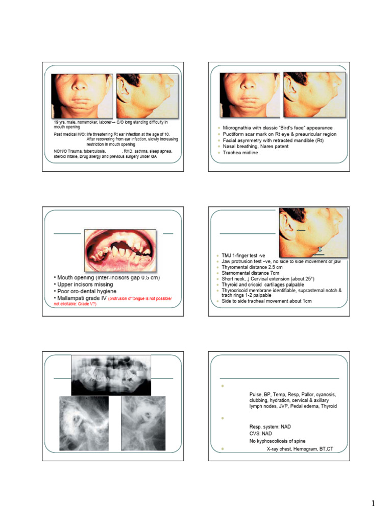 TMJ | PDF | Clinical Medicine | Medical Specialties