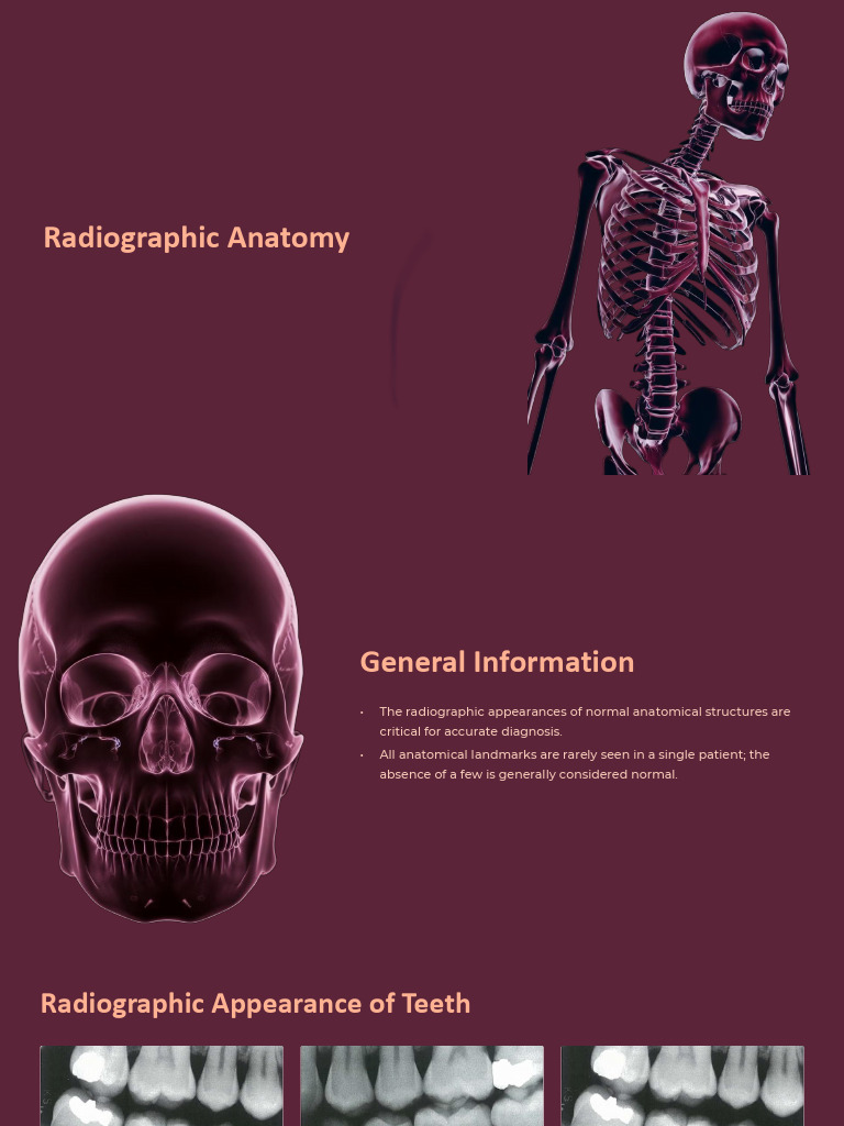 w7 Radiographic-Anatomy | PDF | Dental Anatomy | Human Tooth