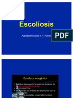 7- Escoliosis