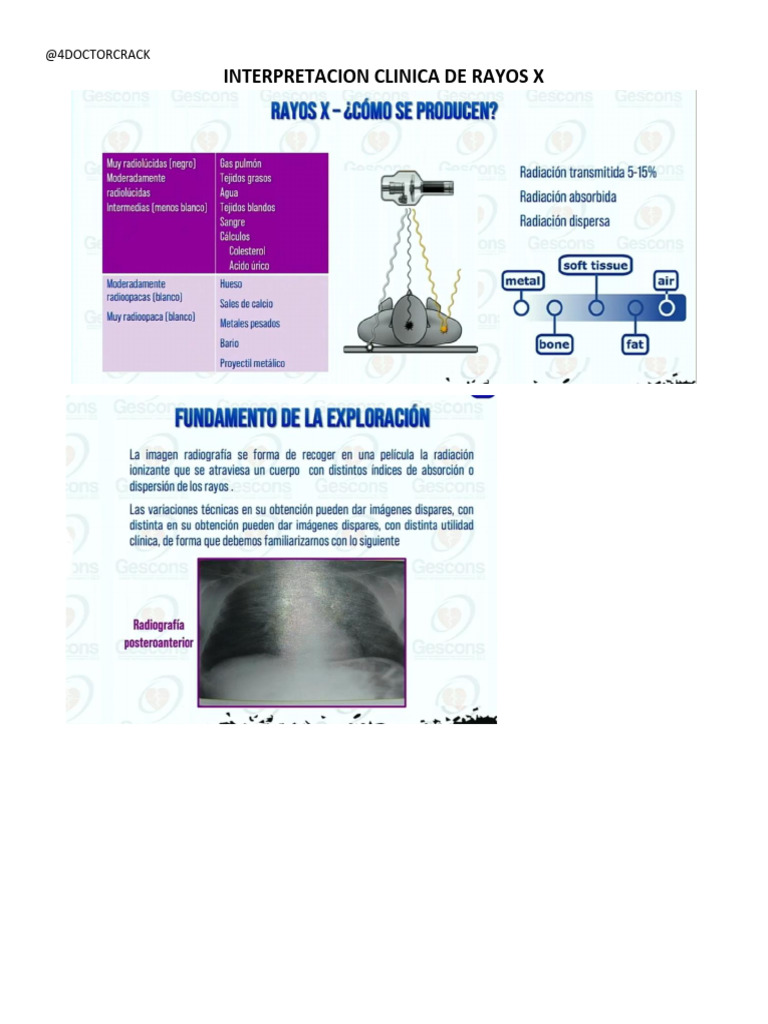 Interpretación de Rayos X en Diagnóstico | PDF