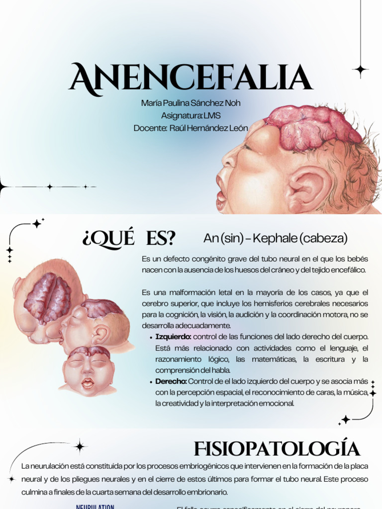Anencefalia: Definición y Tratamiento | PDF | Cerebro | Neurociencia