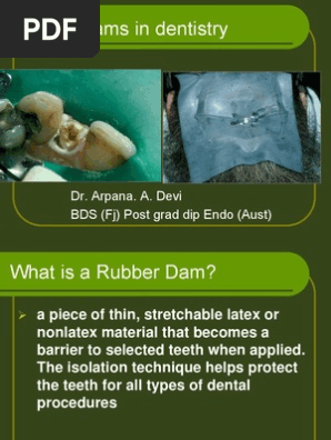 Rubber Dam Lecture