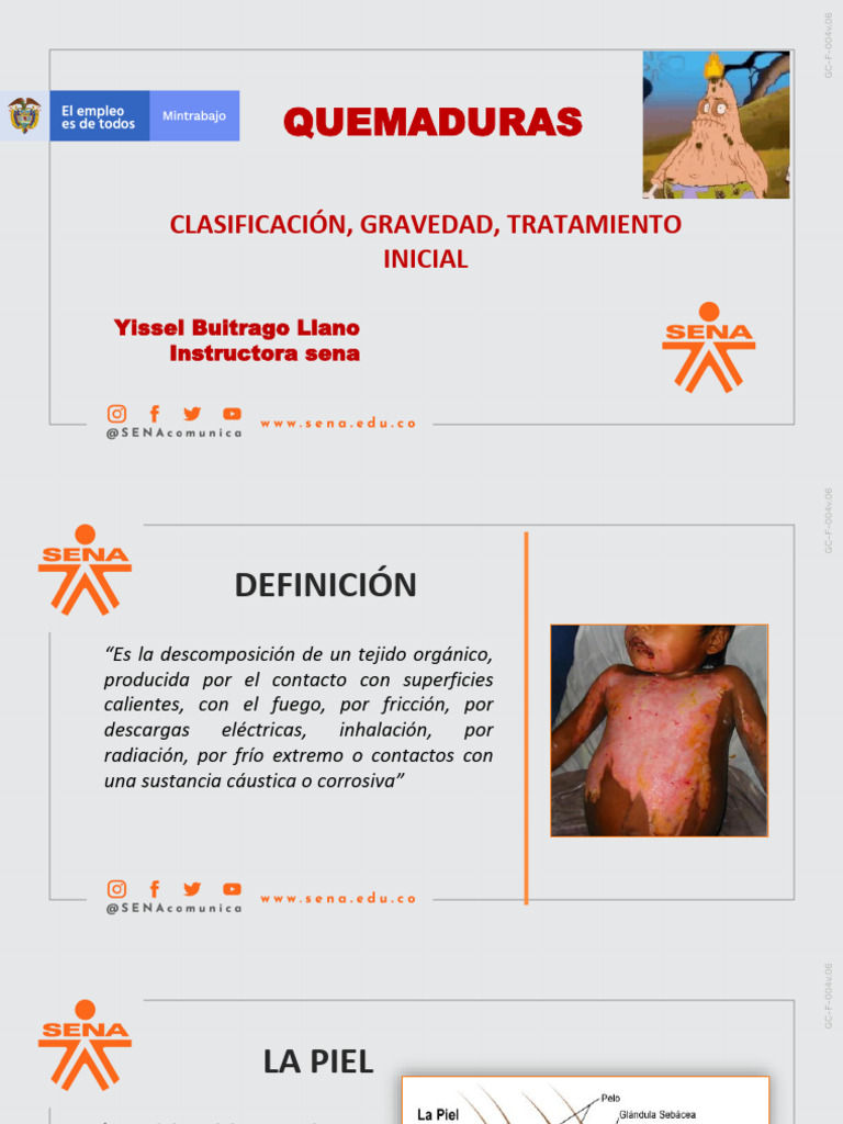 Clasificación y Tratamiento de Quemaduras | PDF | Quemar | Piel