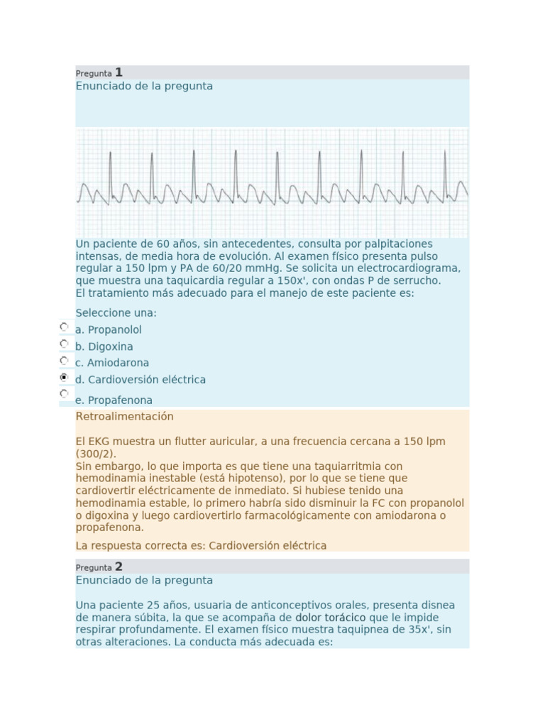 Cardio 2 | PDF | Electrocardiografia | Infarto de miocardio