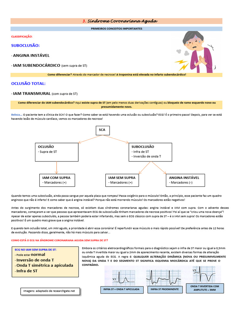 Síndrome Coronariana Aguda: Diagnóstico e Tratamento | PDF | Infarto do ...
