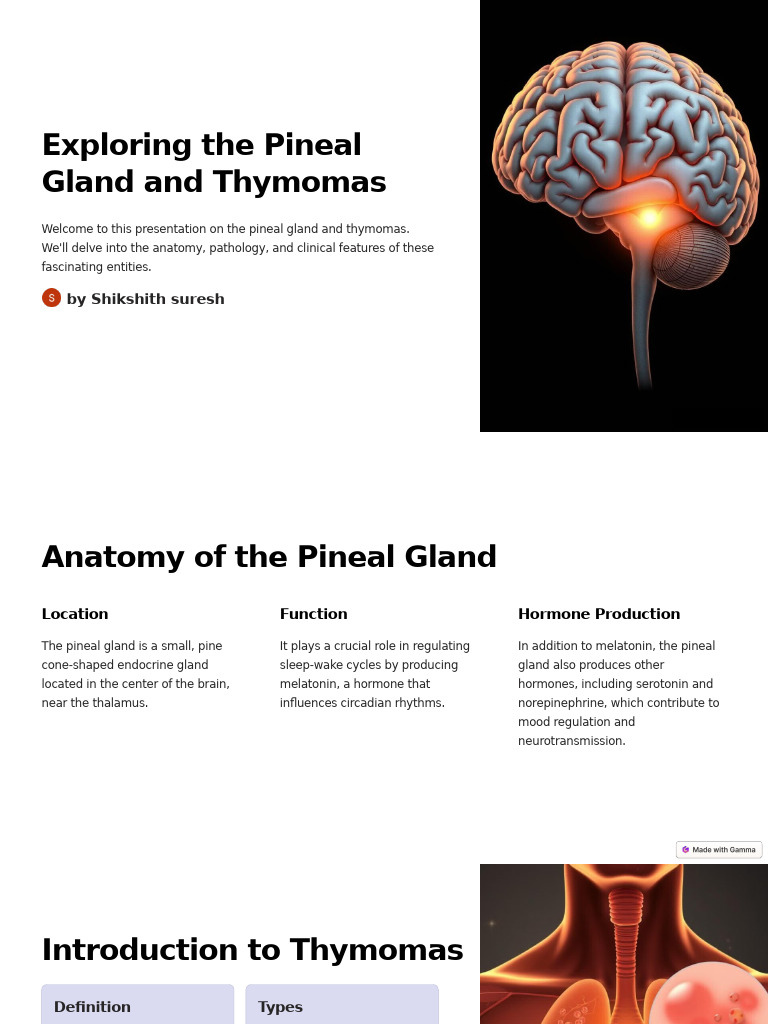Exploring The Pineal Gland and Thymomas | PDF | Thymus | Radiation Therapy
