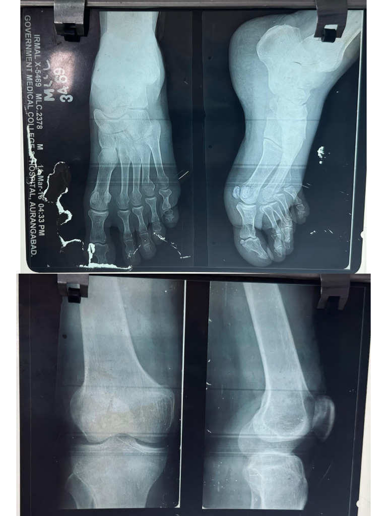X-Rays of Upper and Lower Limb | PDF