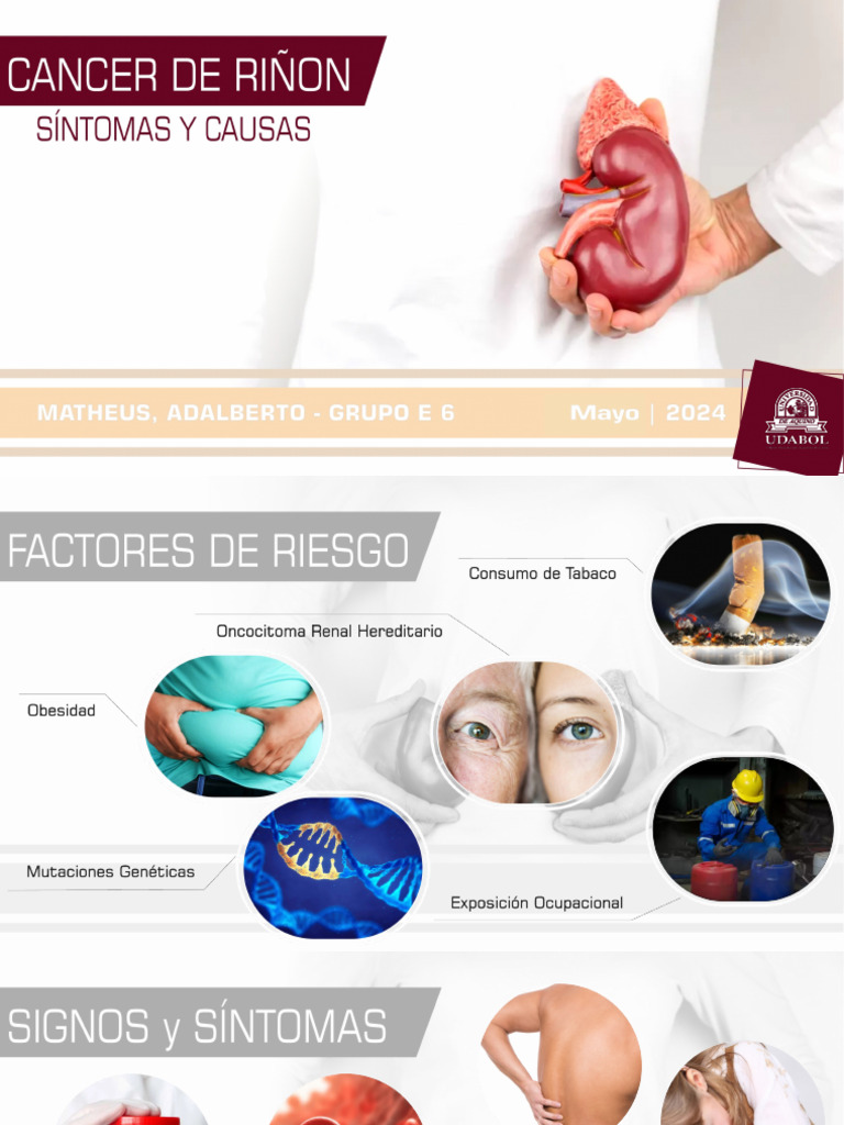 Cancer de Riñon | PDF