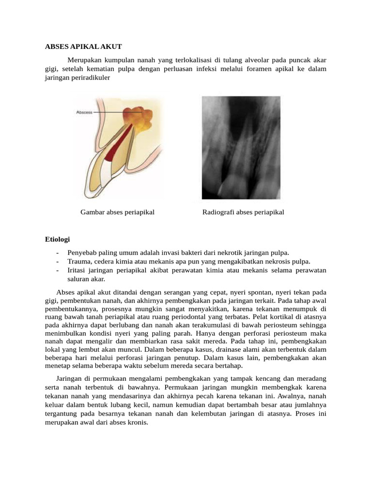 Abses Apikal Akut | PDF
