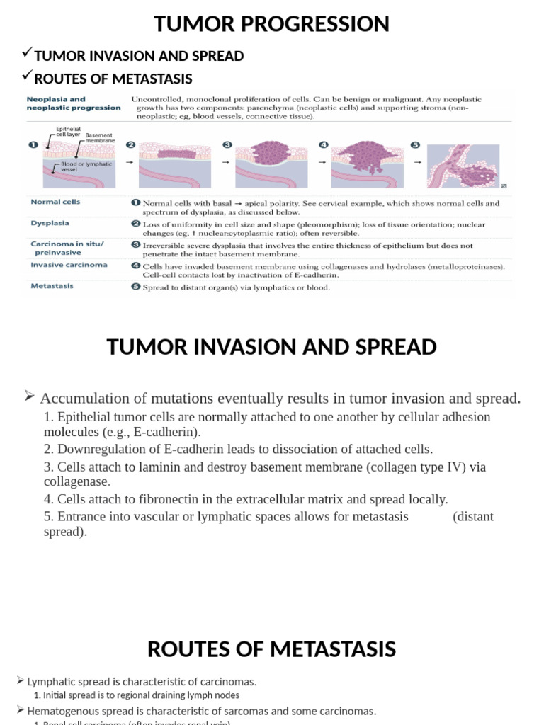 Cancer Biology 4 | PDF | Metastasis | Carcinoma