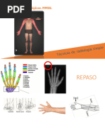 Proyecciones Radiológicas de Mano | PDF | Mano | Anatomía
