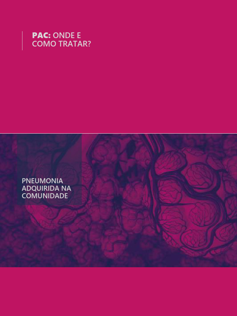Pneumonia Adquirida Na Comunidade - 240417 - 094216 | PDF | Pneumonia ...