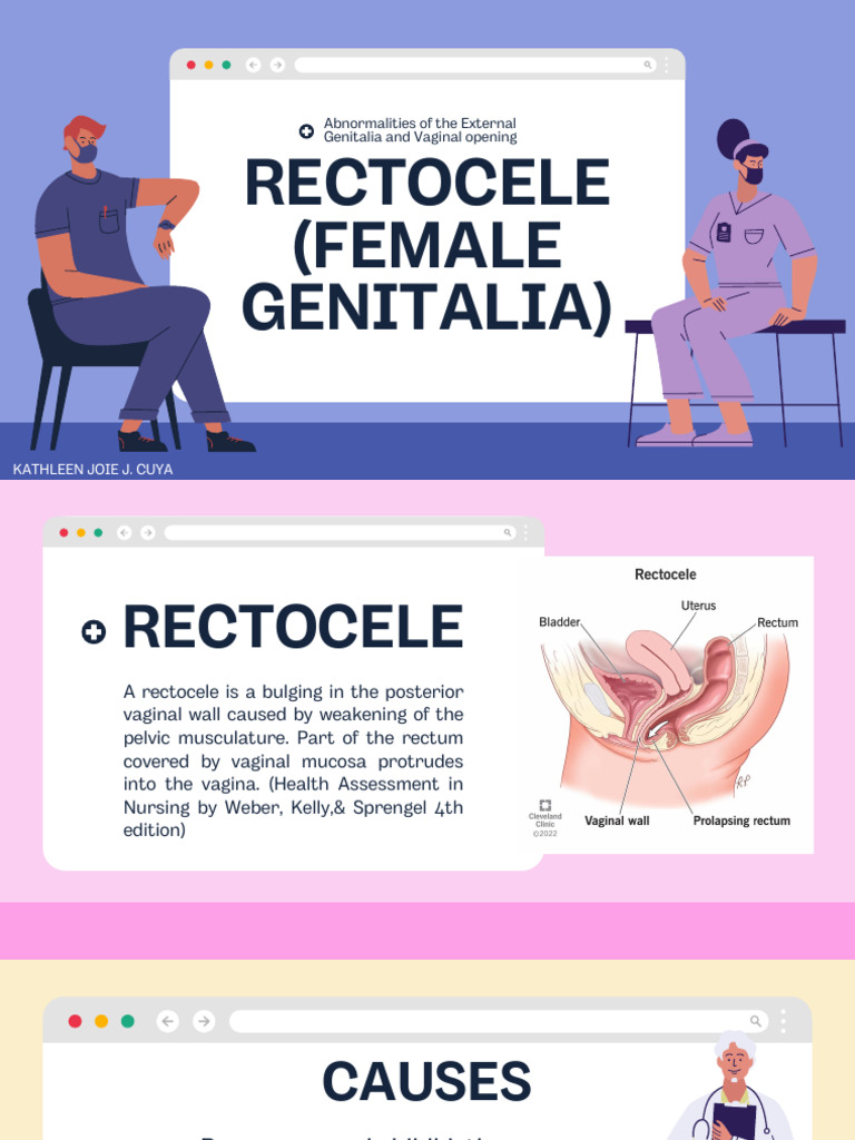 Understanding Rectocele and Hydrocele | PDF