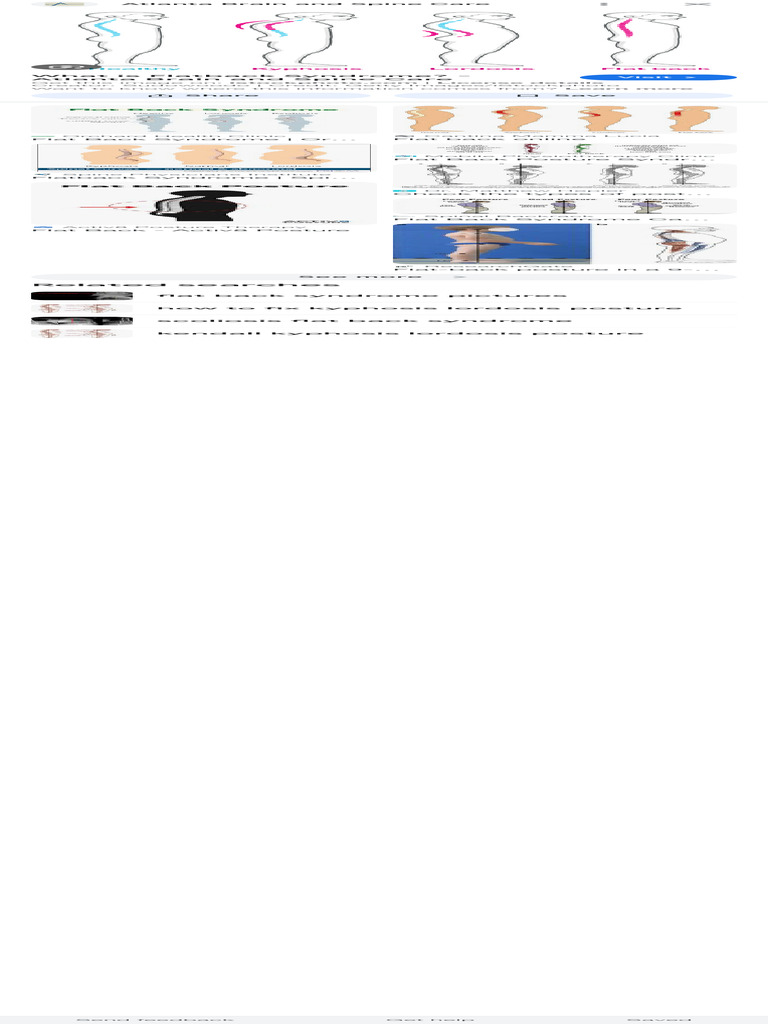 Understanding Flatback Syndrome | PDF