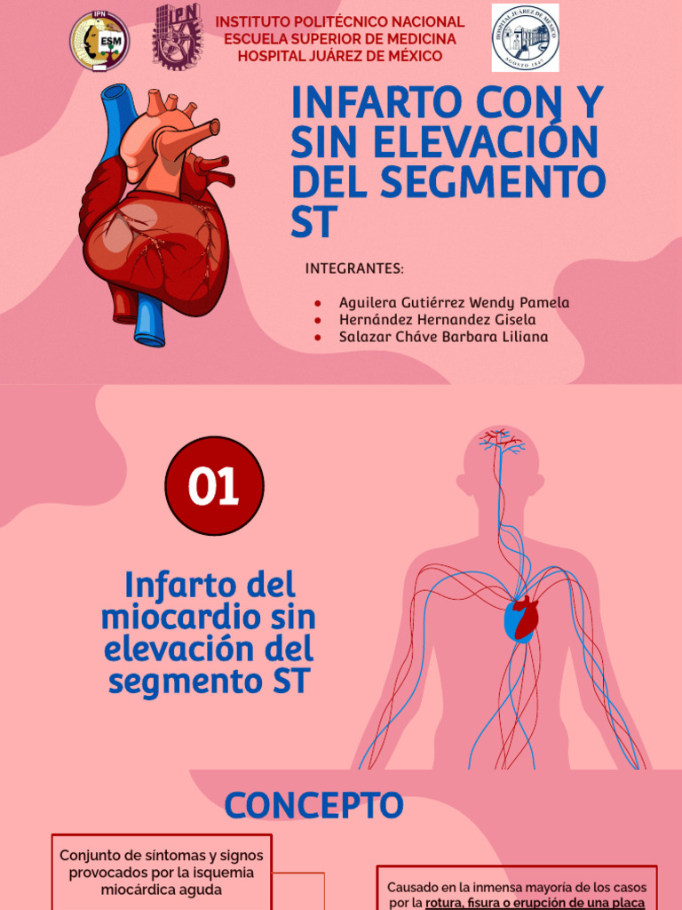 Infarto Miocárdico: ST Elevado y No Elevado | PDF | Infarto de ...