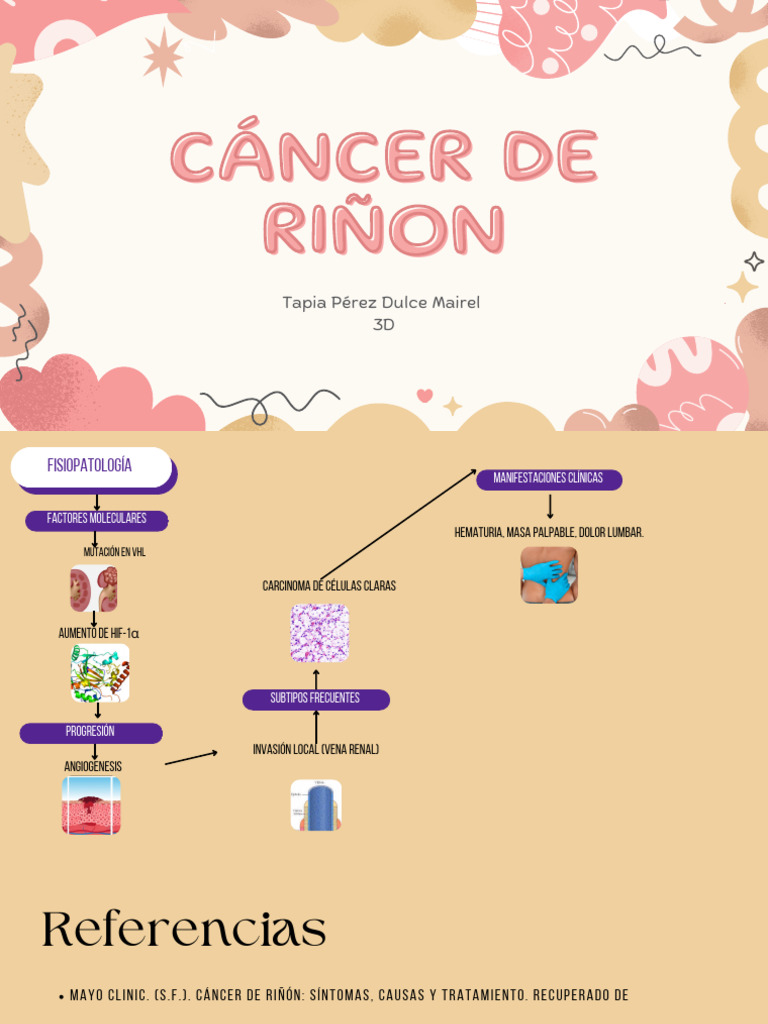 Cáncer de Riñón - 20250123 - 084847 - 0000 | PDF