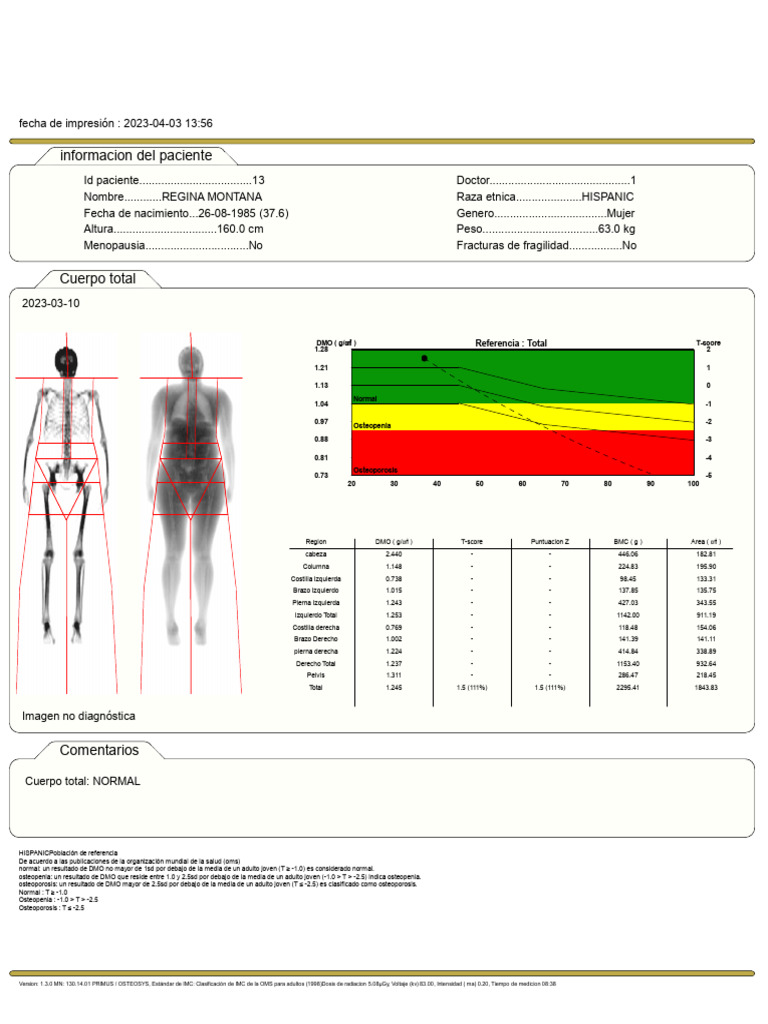 Regina Montana Osteosys | PDF | Índice de masa corporal | Osteoporosis