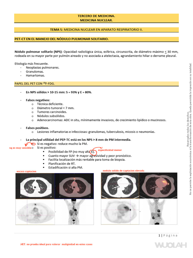 PET-CT en Nódulos Pulmonares y Cáncer | PDF | Cáncer de pulmón ...