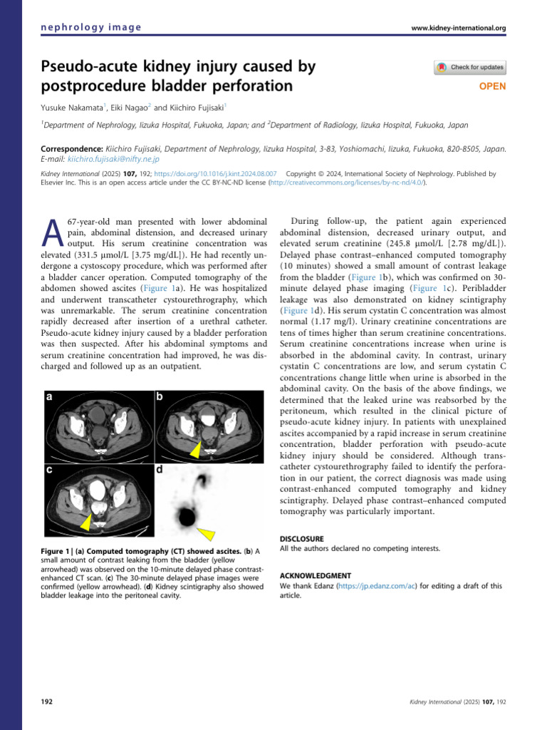 Bladder Perforation and Pseudo-AKI Case | PDF | Peritoneum | Ct Scan