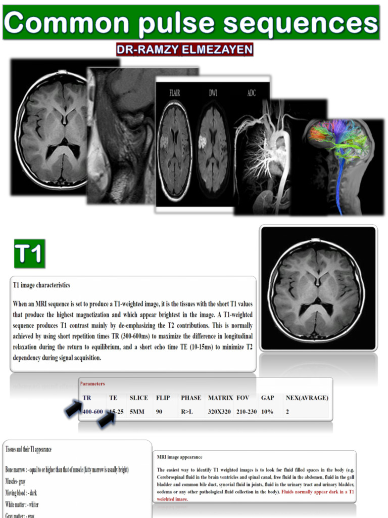 MRI Pulse Sequences and Techniques Overview | PDF | Magnetic Resonance ...