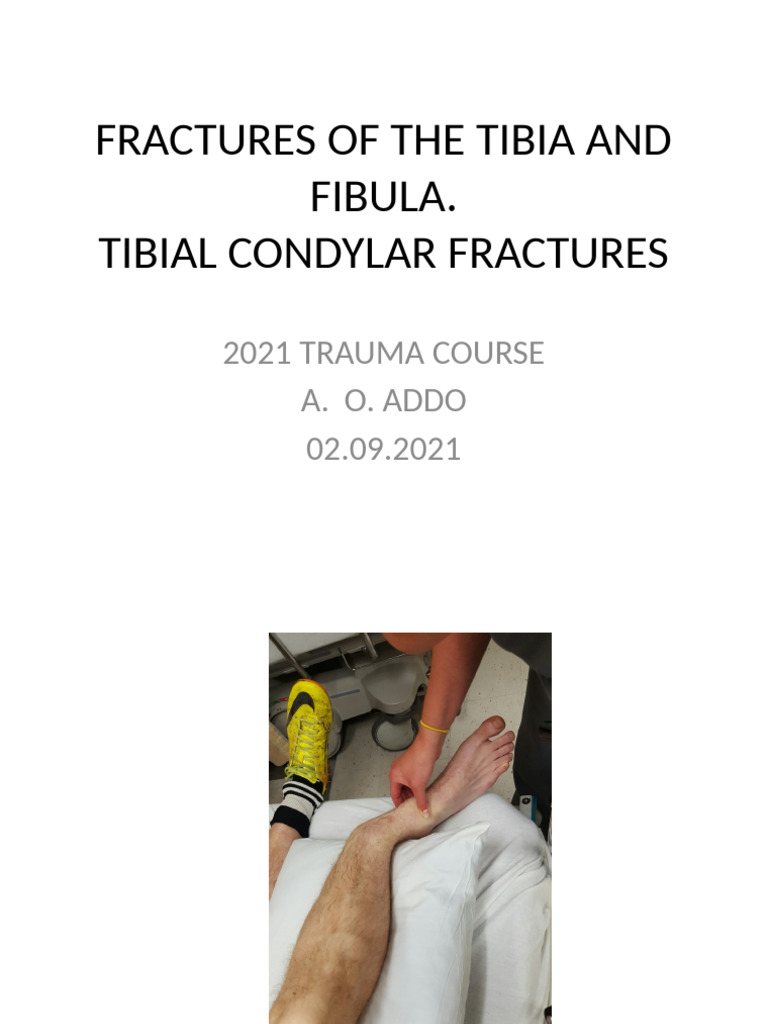 Fractures of Tibia and Fibula 26.08.21 | PDF | Surgical Specialties ...