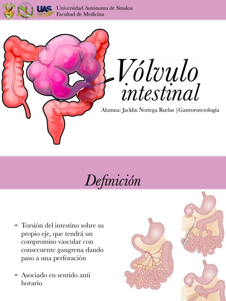 Vólvulo: Epidemiología y Tratamiento | PDF | Estreñimiento ...