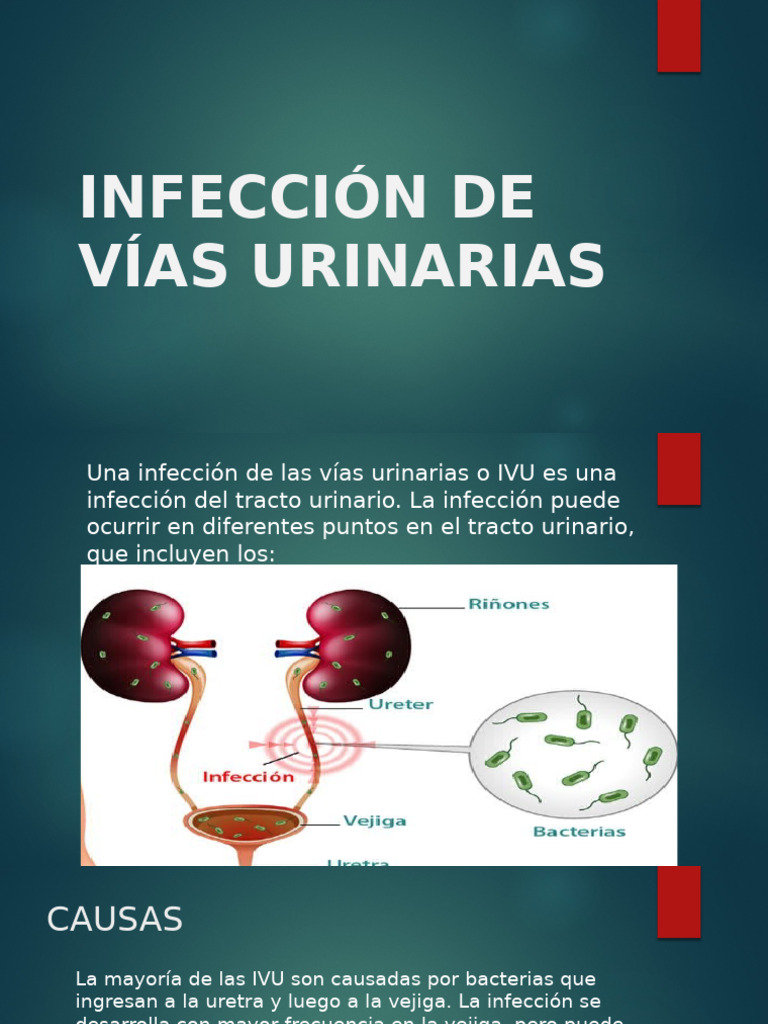 Infección de Vías Urinarias: Causas y Tratamiento | PDF | Sistema ...
